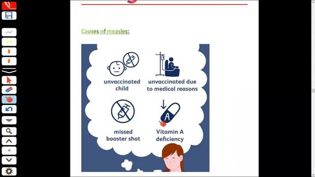 Measles and Mumps | Infectious Diseases | Davidson Medicine смотреть онлайн
