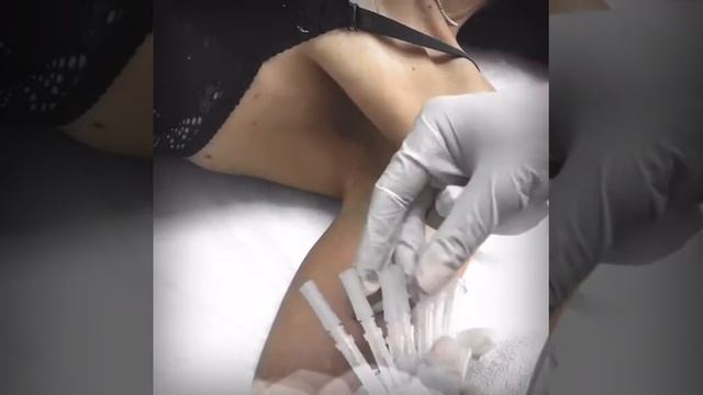 Тредлифтинг смотреть онлайн