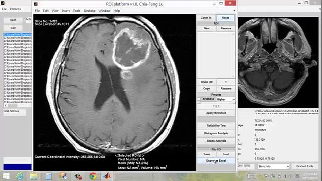 Demo of DICOM Image processing platform смотреть онлайн