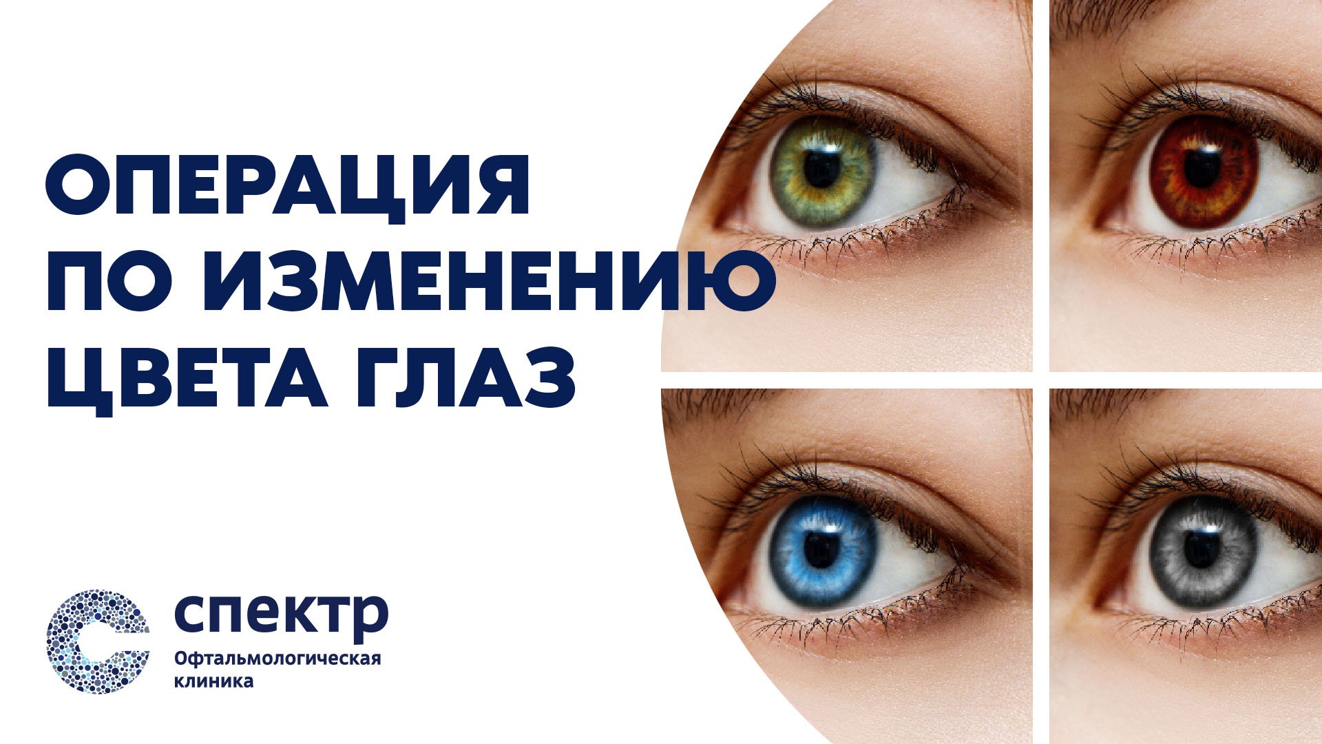 Операция по изменению цвета глаз лазером. смотреть онлайн