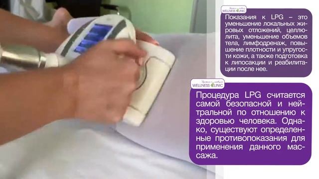 Об LPG - массаже смотреть онлайн