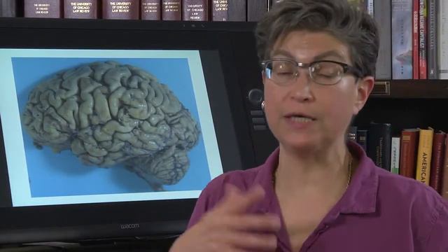 Синдромы инсульта от проф. Пегги Мейсон, университет Чикаго, с русской озвучкой