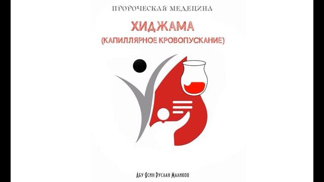 29) Хиджама - капиллярное кровопускание смотреть онлайн
