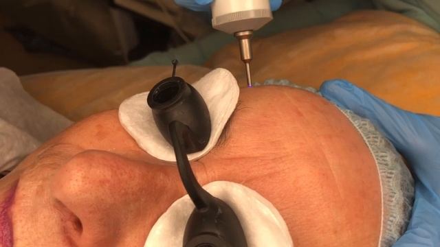 OLA - сеть салонов красоты №1 RF-лифтинг лица. Врач-косметолог Е.Н.Воробьева смотреть онлайн