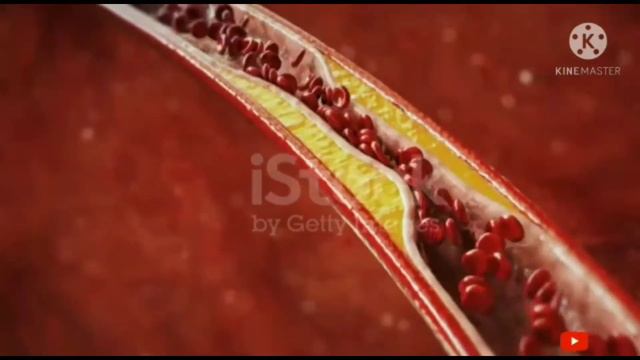 Rosuvastatin टैबलेट क्या काम करती हैWhat Rosuvastatin Tablet Works in Hindi смотреть онлайн