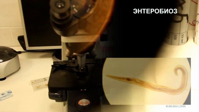 Энтеробиоз. Яйца остриц под микроскопом.Описторхоз. Диагностика паразитов??⚕