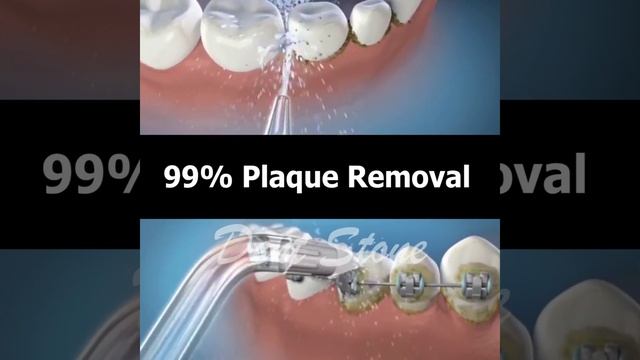 Water Flosser Dental Oral Irrigator смотреть онлайн
