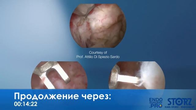 Мастер-класс с профессором Поповым А.А., г.Алматы смотреть онлайн