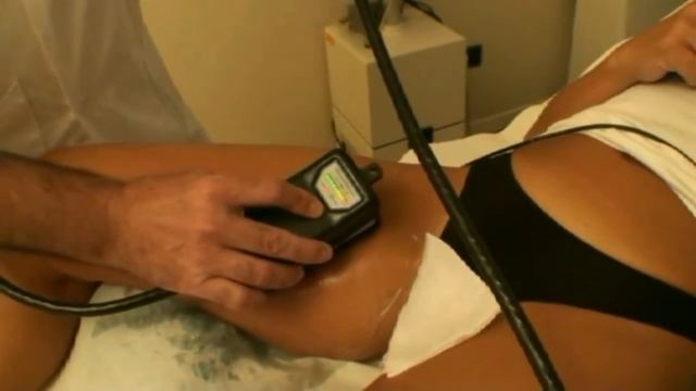 : Радиочастотный лифтинг.Термаж.RF-лифтинг.Клиника лазерной косметологии «Вита» в Москве. смотреть онлайн