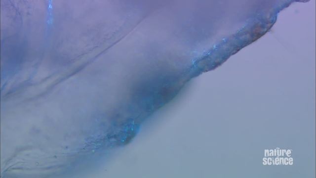 Irukandji Jellyfish - World's deadliest fishing смотреть онлайн