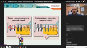 Фундаментальные основы протезирования на имплантатах