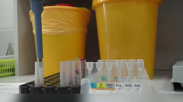 Индивидуальный подбор донорских эритроцитов Crossmatch BioRad смотреть онлайн