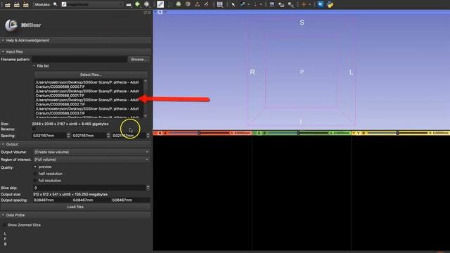 HOW TO: Upload TIF (.tif) Files [3D Slicer Workflow] смотреть онлайн
