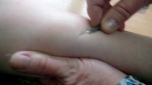 Как делают манту