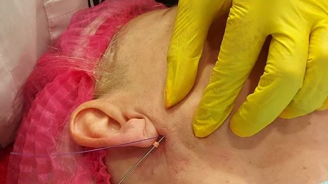 24.09 Нити коллеге(фрагмент). смотреть онлайн