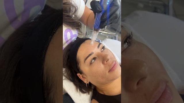 Live with Virtue RF, Microneedling + Smooth Threads ✨ смотреть онлайн