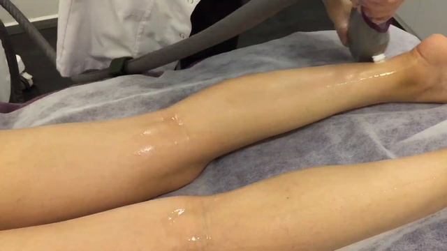 ??♀️ BACAK + KOLTUK ALTI + TÜM YÜZ EPİLASYON NASIL YAPILIR ? ❄️ смотреть онлайн