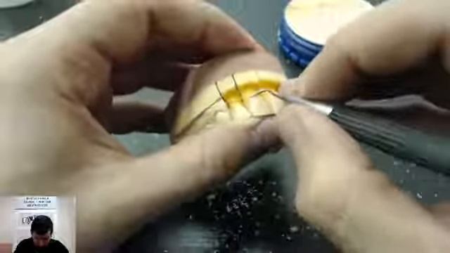 Моделирование 4 фронтальных полноанатомических #waxup под коронки #emax смотреть онлайн