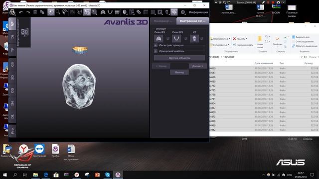 Обучающее видео от Avantis3D - Виртуальный пациент: импорт объектов смотреть онлайн