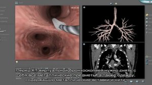 КТ-виртуальная бронхоскопия в Москве