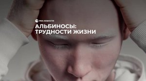 Альбиносы: трудности жизни