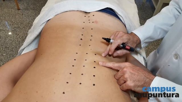 Punto X Punto: Meridiano De Vejiga - Prof. Raúl Ucieza | Campus Acupuntura