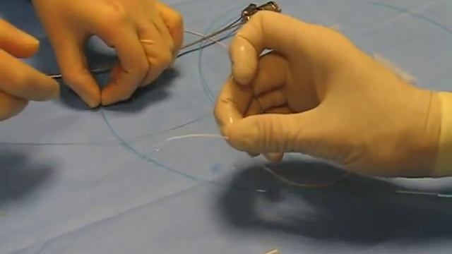 Использование балончатого катетера смотреть онлайн