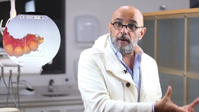 Scanner Dental: como fazer a moldagem dos dentes? escanear os dentes? смотреть онлайн
