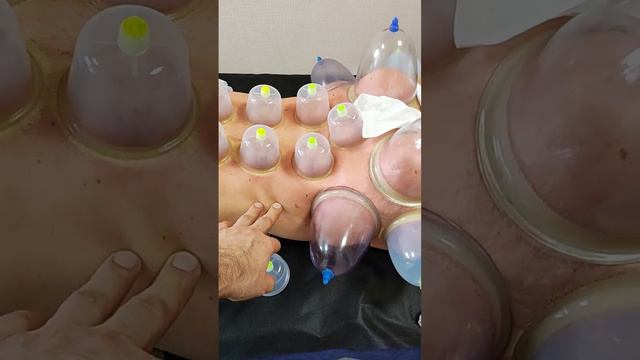 Жалоба на левый тазобедренный сустав. смотреть онлайн