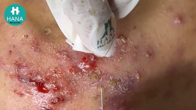 Enjoy Your Day with HANA Spa - Clinic #38 смотреть онлайн