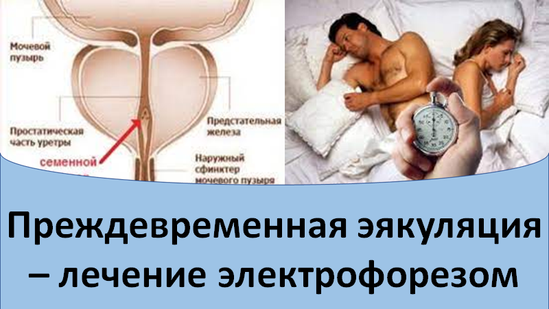 Преждевременная эякуляция - лечение электрофорезом смотреть онлайн