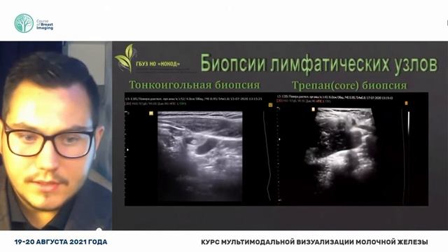 УЗИ лимфатических узлов в онкологии смотреть онлайн