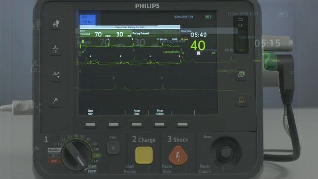 Non-Invasive Transcutaneous Pacing with the HeartStart Intrepid monitor/defibrillator смотреть онлайн