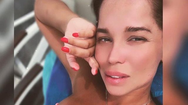 Юлия Салибекова ужаснула отеками и бинтами на голове! смотреть онлайн