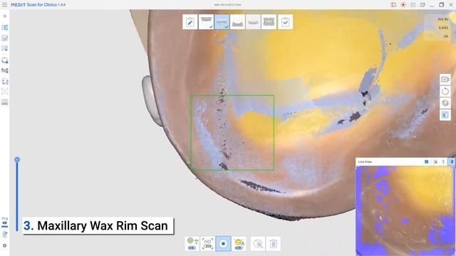 Edentulous Scan Strategy смотреть онлайн