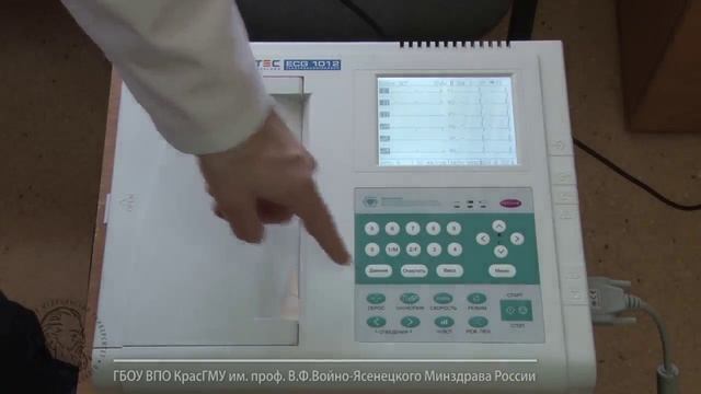 Запись электрокардиограммы смотреть онлайн