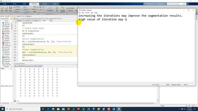 Brain and Tumor Segmentation using Active Contour Model смотреть онлайн