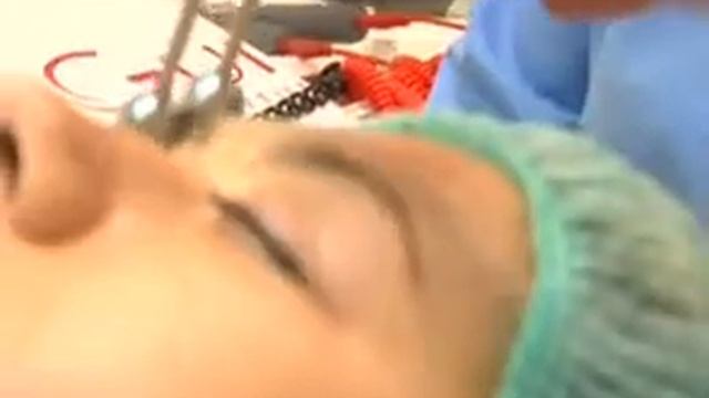 Современные методы омоложения смотреть онлайн