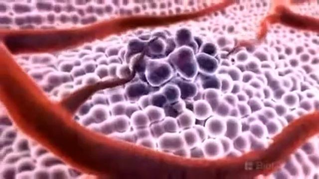 Просто о раке смотреть онлайн