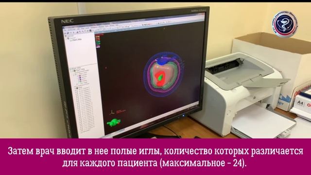 Брахитерапия в МРНЦ им. А.Ф. Цыба – филиал ФГБУ «НМИЦ радиологии» Минздрава России смотреть онлайн
