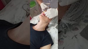 Биоревитализация губ. Deep lips hydration.