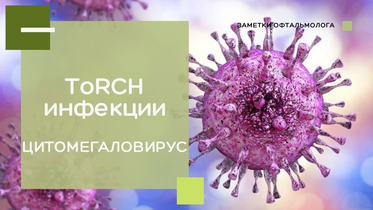 ToRCH-инфекции / ЦИТОМЕГАЛОВИРУС