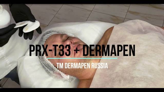 Протокол процедуры PRX-T33 и Дермапен DRA6 Premium. Правильное исполнение. смотреть онлайн