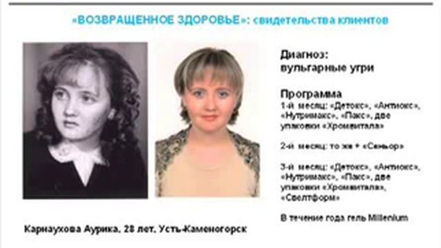 Вульгарные угри Аурика Карнаухова смотреть онлайн