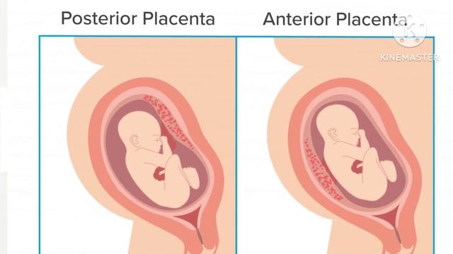 ultrasound report boy or girl in hindi || ultrasound reports kaise dekhe // FHR means in pregency смотреть онлайн