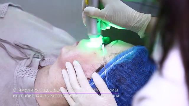Антиэйдж омоложение на аппарате Q Swich| Лазерная косметология Кюсвич смотреть онлайн