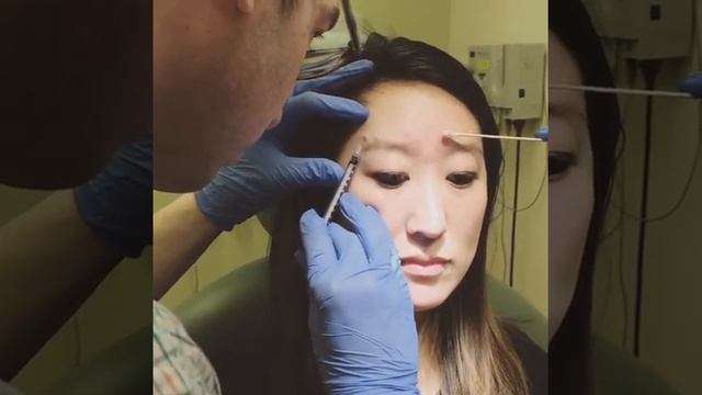 Botox Live Demo смотреть онлайн