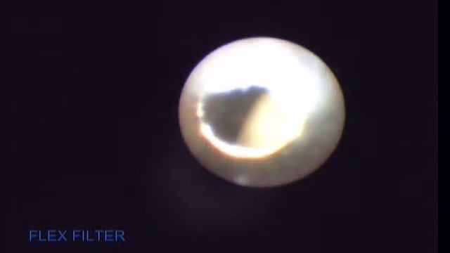 Shoulder arthroscopy : 1.1mm Mini arthroscopy смотреть онлайн