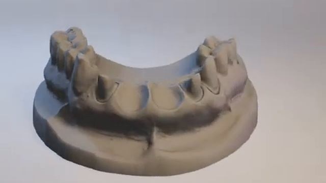 Bredent Schaumodell IDS 2017 by DASADent GmbH смотреть онлайн