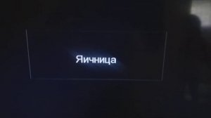 нет сигнала на телевизоре